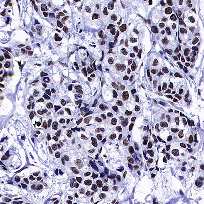 Histone H3 Recombinant Rabbit mAb (S-5672)