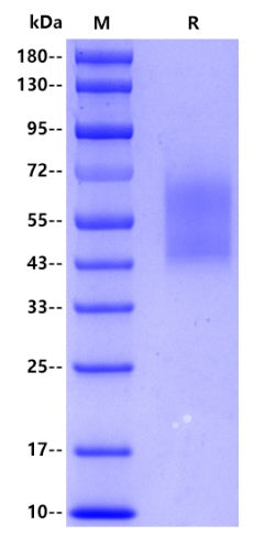 Human CD44s, His tag