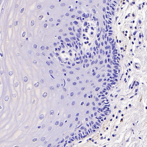 CDKN2A/p16 INK4A Recombinant Mouse mAb (SDT-4677)