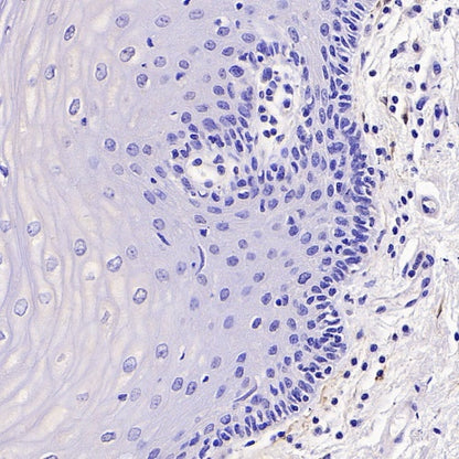 CDKN2A/p16 INK4A Recombinant Mouse mAb (SDT-4677)