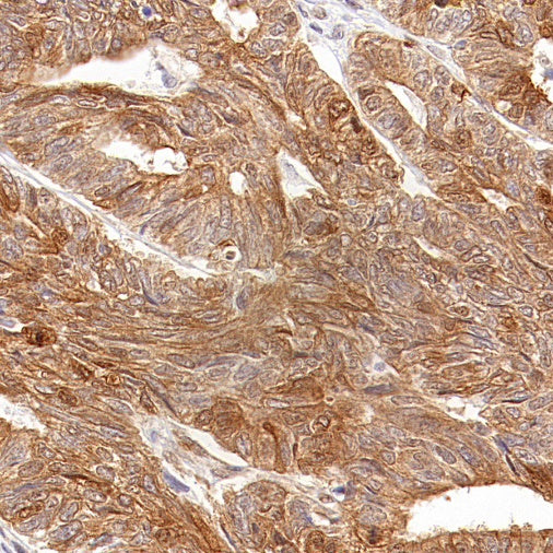 BAG3 Recombinant Rabbit mAb (S-1837-22)