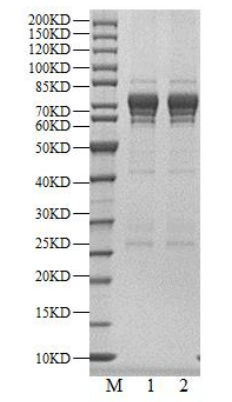 CSNK1D(CK1d) GST Tag Protein, Human