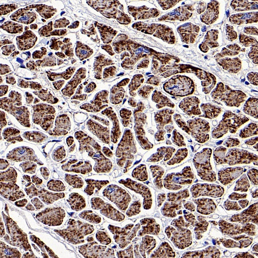 NDUFS8 Recombinant Rabbit mAb (S-1273-10)