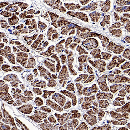NDUFS8 Recombinant Rabbit mAb (S-1273-10)