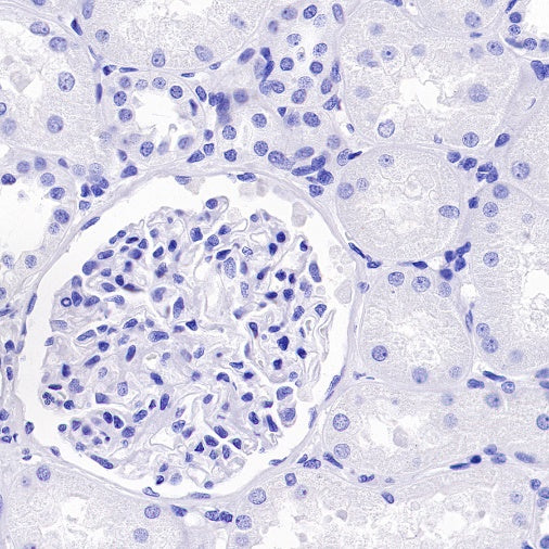 DLL3 Recombinant Rabbit mAb (S-207-179)