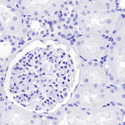 DLL3 Recombinant Rabbit mAb (S-207-179)
