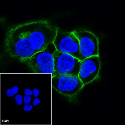 CD44v6 Mouse mAb (S-945-76)