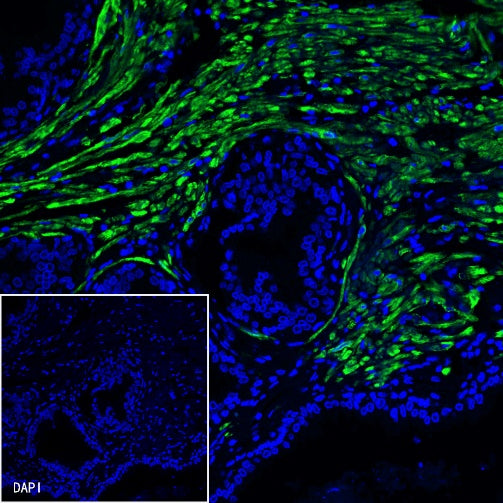 S-RMab® Desmin Recombinant Rabbit mAb (SDT-109-114)