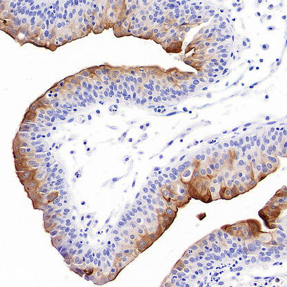 Uroplakin II/UPII Recombinant Rabbit mAb (SDT-6121)