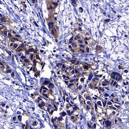 Factor XII (FXII) Recombinant Rabbit mAb (S-4487-31)