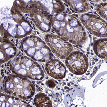 Caspase-8 Recombinant Rabbit mAb (S-2676-121)