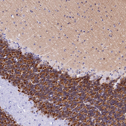 KCND2 Recombinant Rabbit mAb (S-3102-32)