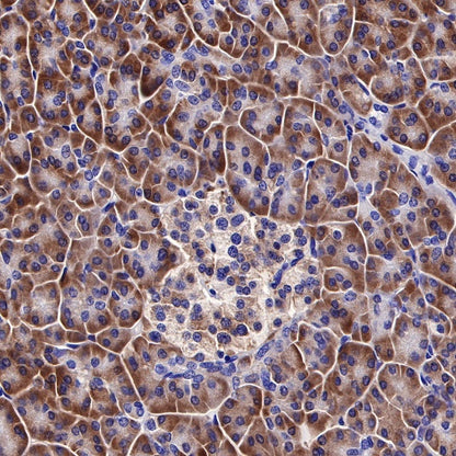 RPL26L1 Recombinant Rabbit mAb (S-R317)