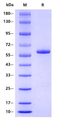 Human Catalase Protein, His tag