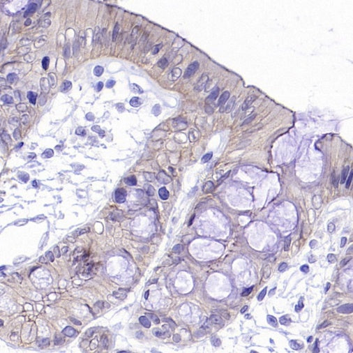 Occludin Recombinant Rabbit mAb (SDT-4588)