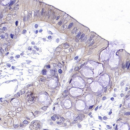 Occludin Recombinant Rabbit mAb (SDT-4588)
