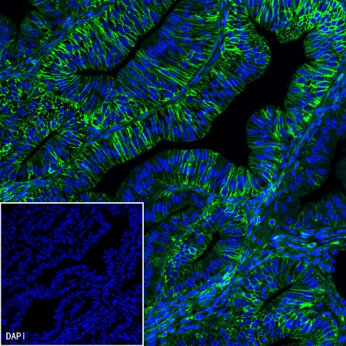 CD44 Recombinant Rabbit mAb (SDT-R107)