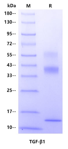 TGF-β1 His Tag Protein, Human