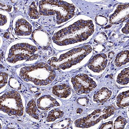 SDHA Recombinant Rabbit mAb (S-1458-43)