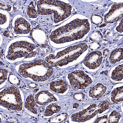 SDHA Recombinant Rabbit mAb (S-1458-43)