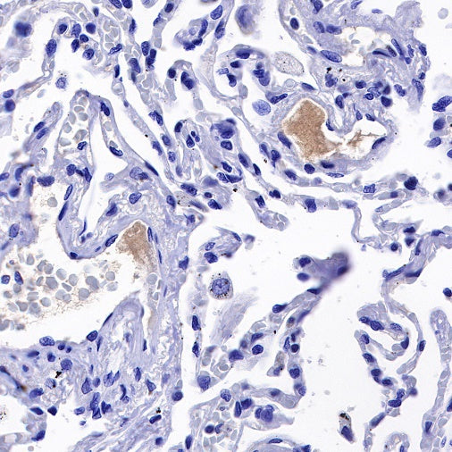C1q Recombinant Rat mAb (S-R189)