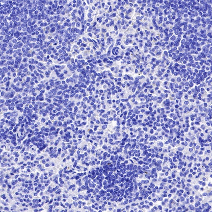 TFF1 Recombinant Rabbit mAb (S-481-16)