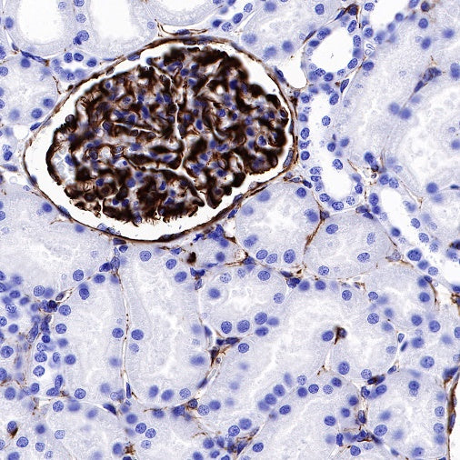 Vimentin Recombinant Rabbit mAb (SDT-029-120)