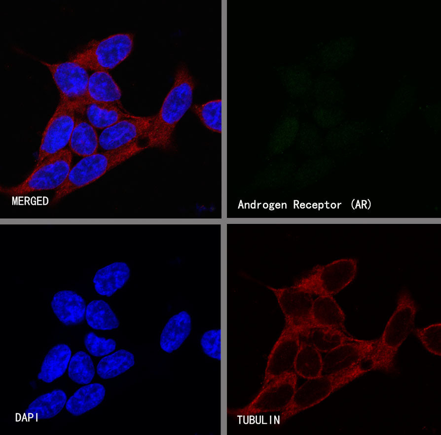 Androgen Receptor Recombinant Rabbit mAb (SDT-R167)