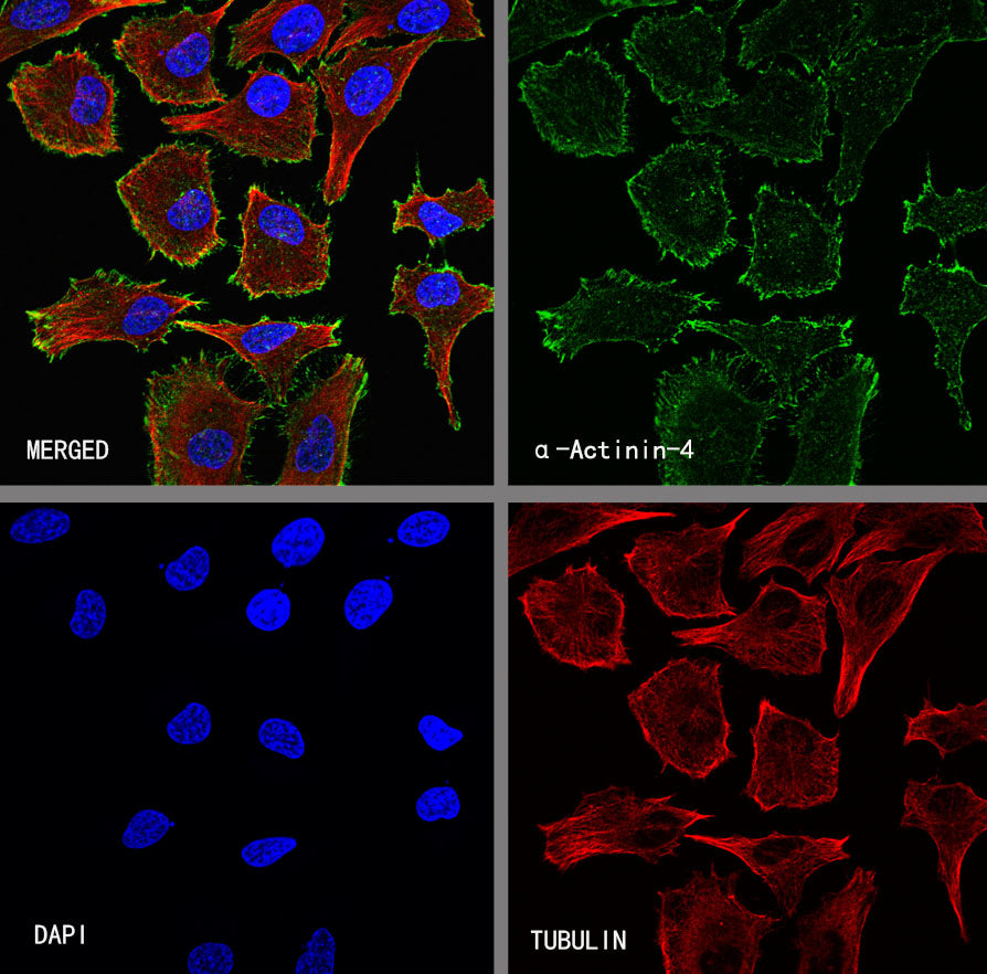 α-Actinin-4 Recombinant Rabbit mAb
