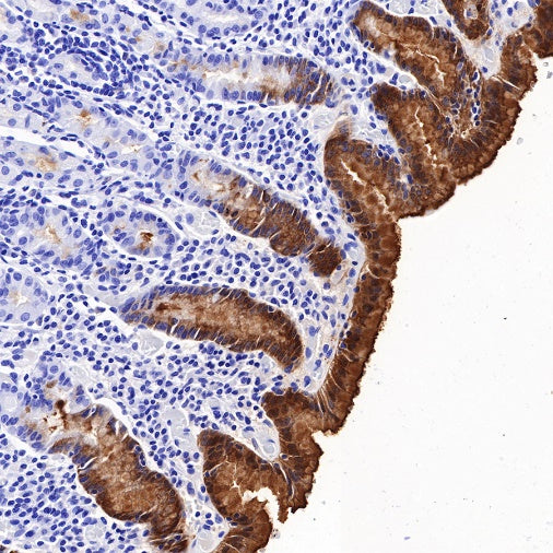 TFF1 Recombinant Rabbit mAb (S-481-16)
