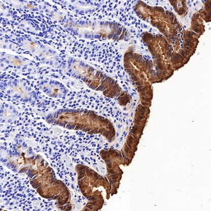 TFF1 Recombinant Rabbit mAb (S-481-16)