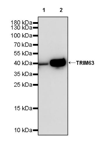 TRIM63 Recombinant Rabbit mAb (S-2304-110)