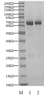 GSK-3β Protein