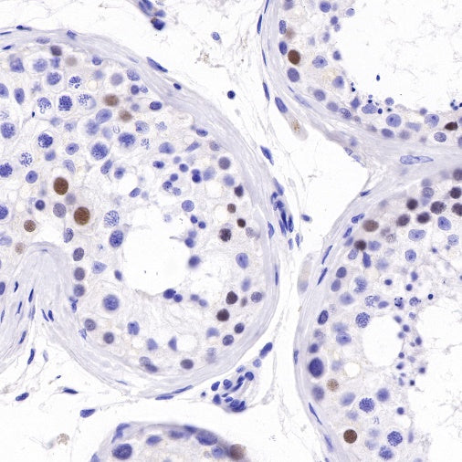 SAGE1 Recombinant Rabbit mAb (SDT-317-60)