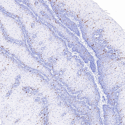 CD1A Recombinant Rabbit mAb (SDT-R086)