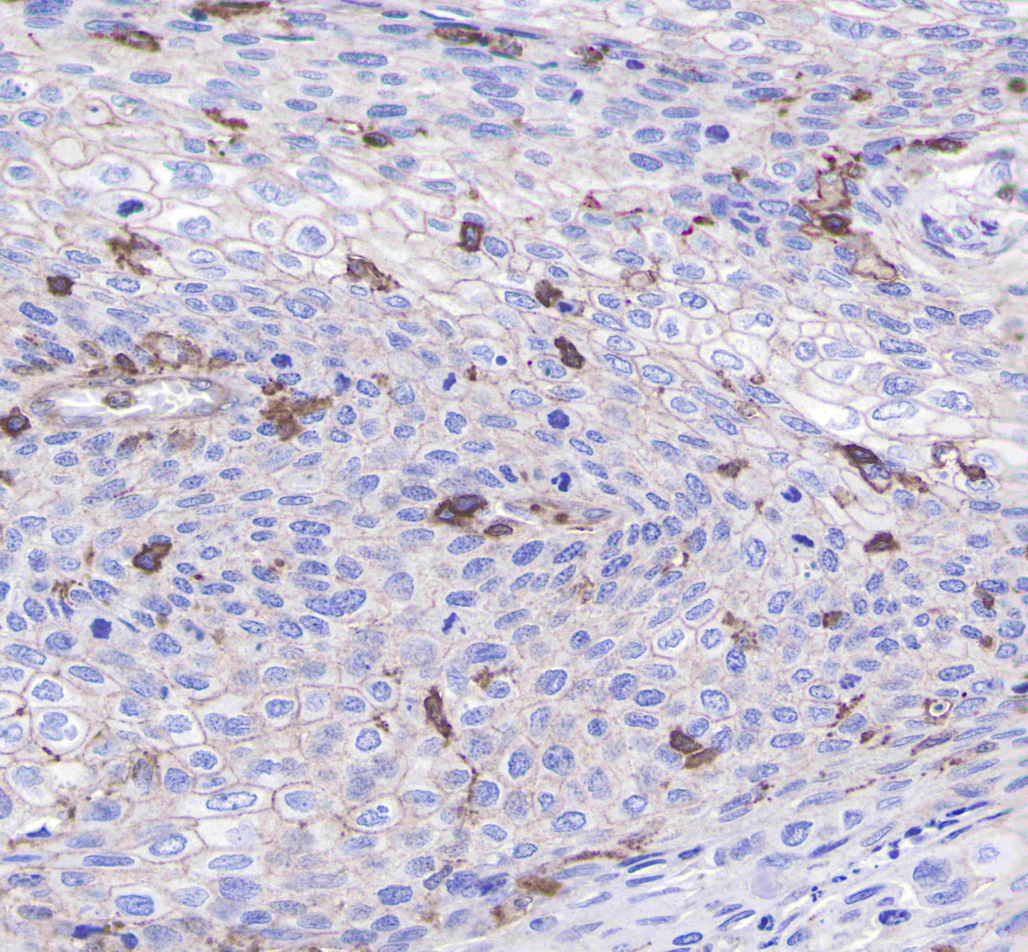 CD206 Recombinant Rabbit mAb(SDT-022-2)