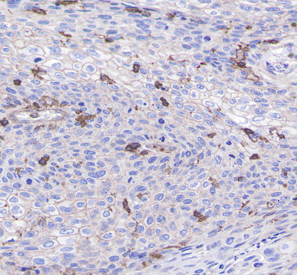 CD206 Recombinant Rabbit mAb(SDT-022-2)