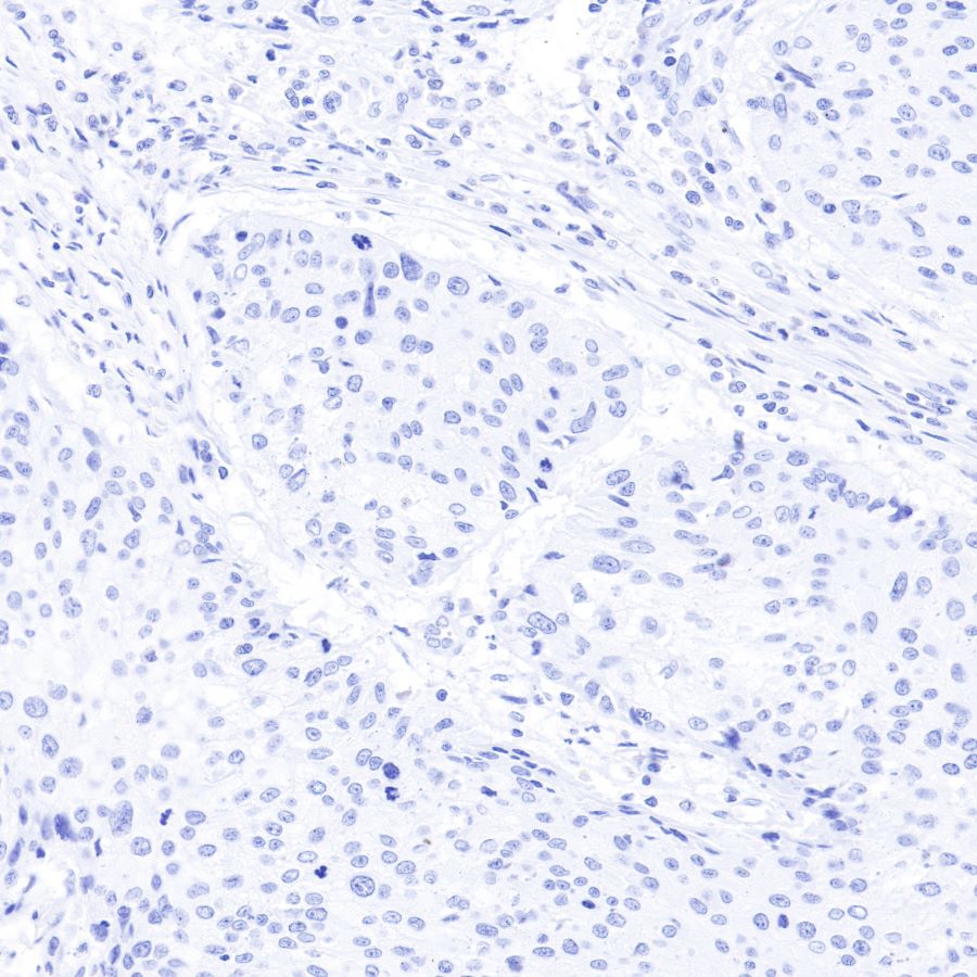 Insulin Recombinant Rabbit mAb (SDT-026-17)