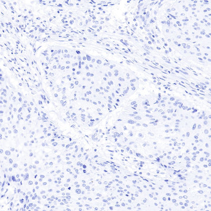 Insulin Recombinant Rabbit mAb (SDT-026-17)