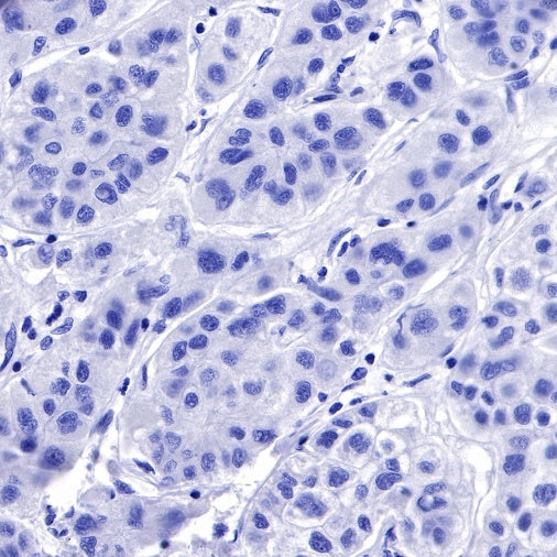 IMP-3 Recombinant Rabbit mAb (S-439-10)