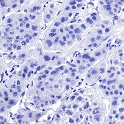IMP-3 Recombinant Rabbit mAb (S-439-10)