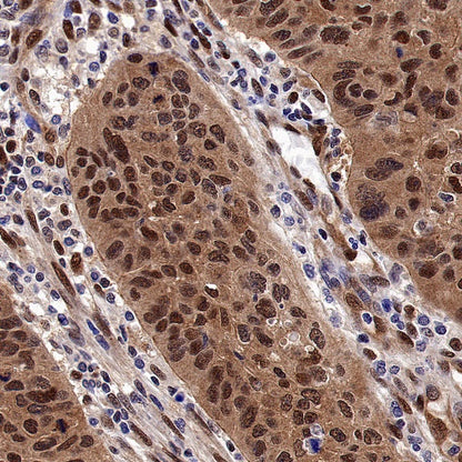 DYNLL1/PIN Recombinant Rabbit mAb (S-1460-8)