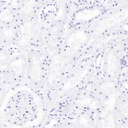 TBR2/Eomes Recombinant Rabbit mAb (SDT-1101-231)