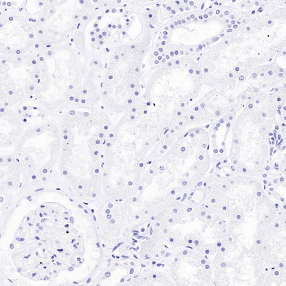 TBR2/Eomes Recombinant Rabbit mAb (SDT-1101-231)