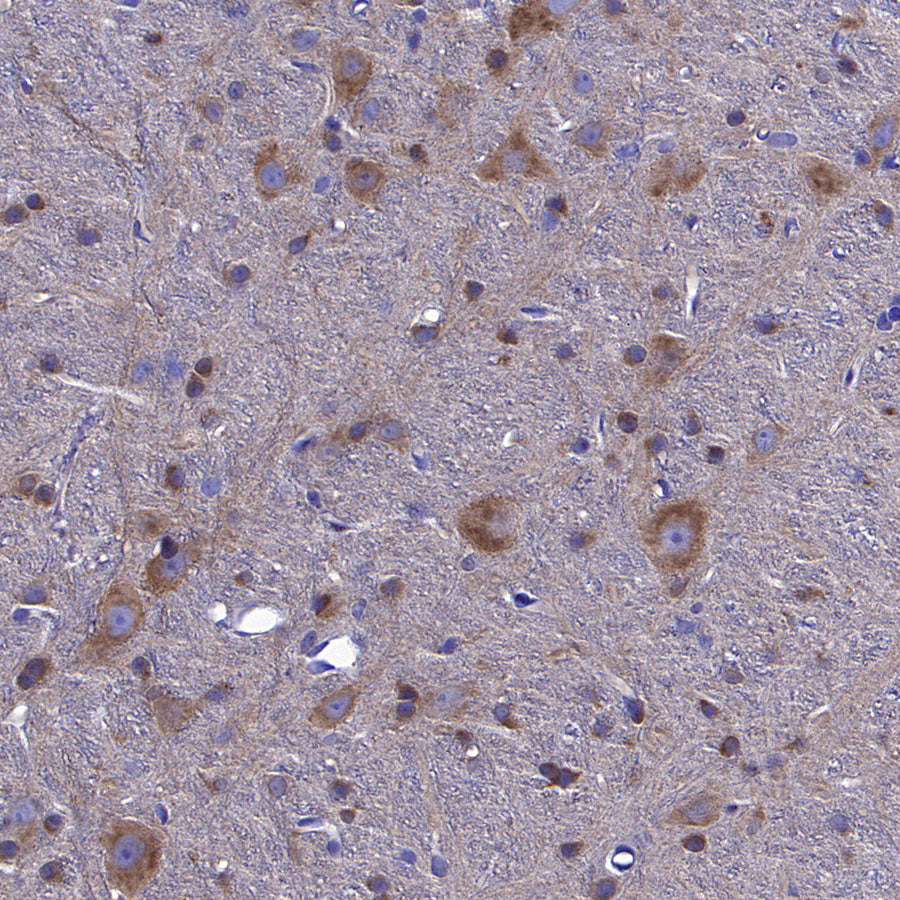 STK39 Recombinant Rabbit mAb (S-3630-15)