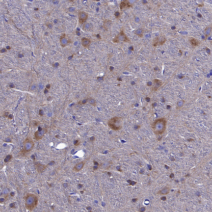 STK39 Recombinant Rabbit mAb (S-3630-15)