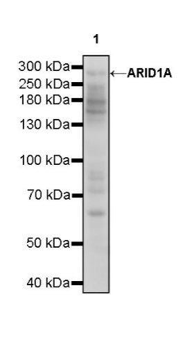 ARID1A Recombinant Rabbit mAb (S-440-62)