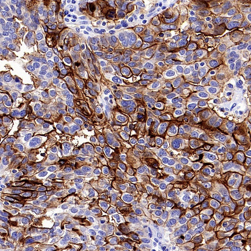 Human folate receptor alpha Recombinant Rabbit mAb (SDT-719-684)