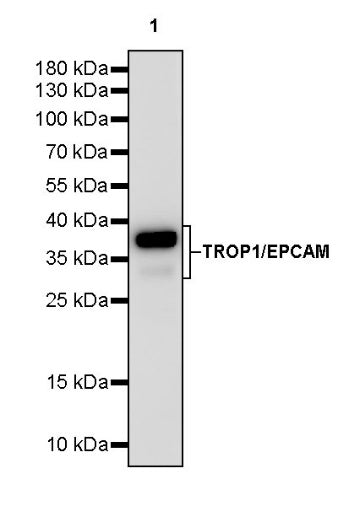TROP1/EPCAM Recombinant Rabbit mAb (S-1379-5)