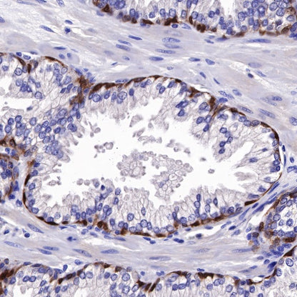ALDH3A1 Recombinant Rabbit mAb (S-R220)